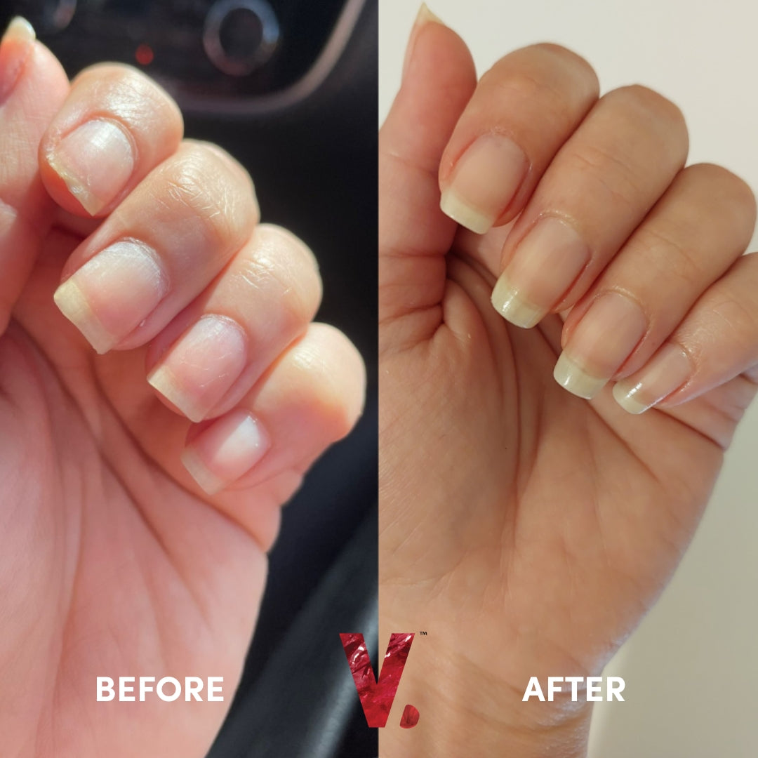 Glow Up Gummies
